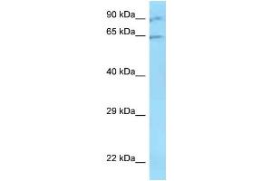 WB Suggested Anti-ZNF280B Antibody   Titration: 1.