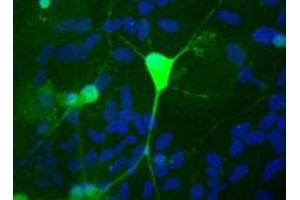 Shows rat mixed neuron/glial cultures stained with UCHL1 polyclonal antibody  (green). (UCHL1 anticorps)