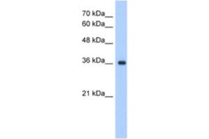 Western Blotting (WB) image for anti-ELOVL Fatty Acid Elongase 7 (ELOVL7) antibody (ABIN2463300) (ELOVL7 anticorps)