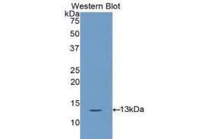 Western Blotting (WB) image for anti-Cystatin A (Stefin A) (CSTA) (AA 1-98) antibody (ABIN1172941) (CSTA anticorps  (AA 1-98))