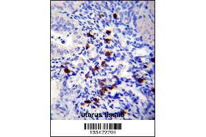 TNN Antibody immunohistochemistry analysis in formalin fixed and paraffin embedded human uterus tissue followed by peroxidase conjugation of the secondary antibody and DAB staining. (Tenascin N anticorps  (AA 587-615))