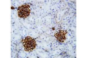 Anti-Collagen IV antibody, IHC(F) IHC(F): Rat Kidney Tissue (COL4a2 anticorps  (C-Term))
