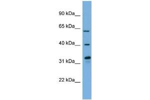 WB Suggested Anti-FMO3  Antibody Titration: 0. (FMO3 anticorps  (N-Term))