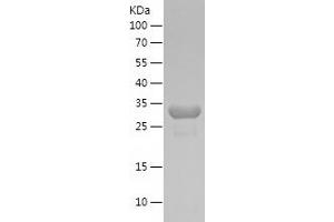 Western Blotting (WB) image for phosphoglycerate Mutase 1 (Brain) (PGAM1) (AA 79-154) protein (His-IF2DI Tag) (ABIN7124419)