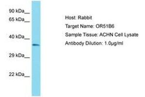 Image no. 1 for anti-Olfactory Receptor, Family 51, Subfamily B, Member 6 (OR51B6) (AA 200-249) antibody (ABIN6750809) (OR51B6 anticorps  (AA 200-249))