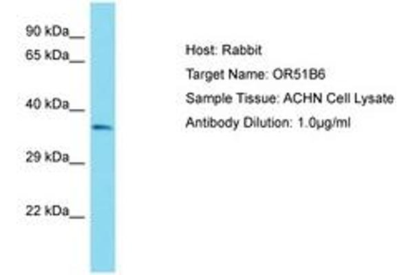 OR51B6 anticorps  (AA 200-249)