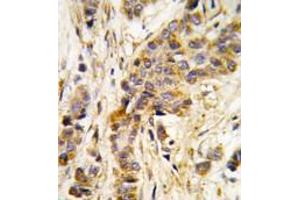 Image no. 1 for anti-Isoleucyl-tRNA Synthetase 2, Mitochondrial (IARS2) (Middle Region) antibody (ABIN360191)
