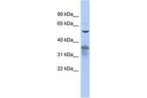 Image no. 1 for anti-RAB3A Interacting Protein (Rabin3) (RAB3IP) (AA 35-84) antibody (ABIN6743738) (RAB3IP anticorps  (AA 35-84))