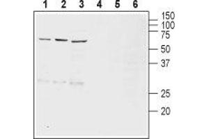 Western blot analysis of rat brain (lanes 1 and 4), mouse brain (lanes 2 and 5) and rat brain stem (lanes 3 and 6) lysates: - 1-3.