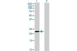 Western Blot analysis of MS4A8B expression in transfected 293T cell line by MS4A8B MaxPab polyclonal antibody. (Membrane-Spanning 4-Domains, Subfamily A, Member 8 (MS4A8) (AA 1-250) anticorps)