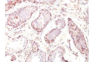 Formalin-fixed, paraffin-embedded human Testicular Carcinoma stained with MAGE-1 Monoclonal Antibody (MZ2E/838). (MAGEA1 anticorps)