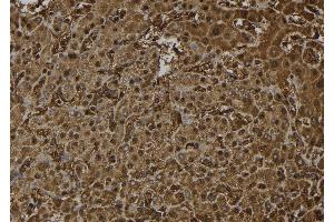 ABIN6272379 at 1/100 staining Human liver tissue by IHC-P. (OTUB2 anticorps  (Internal Region))