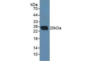 Western blot analysis of Rat Testis Tissue. (CLEC10A anticorps  (AA 71-239))