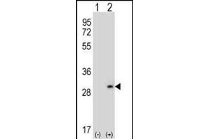Western blot analysis of DPT (arrow) using rabbit polyclonal DPT Antibody (N-term) (ABIN656571 and ABIN2845833). (Dermatopontin anticorps  (N-Term))