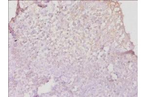 Immunohistochemistry of paraffin-embedded human tonsil tissue using ABIN7155585 at dilution of 1:50 (HLA-DPB1 anticorps  (AA 30-225))