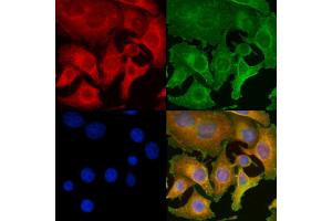ABIN6260728 and ABIN6277053 staining Hela cells by IF/ICC.