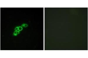 Immunofluorescence analysis of MCF7 cells, using FSHR Antibody. (FSHR anticorps  (AA 278-327))