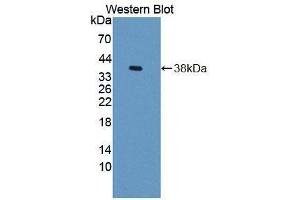 Western blot analysis of the recombinant protein. (GTF3A anticorps  (AA 71-365))