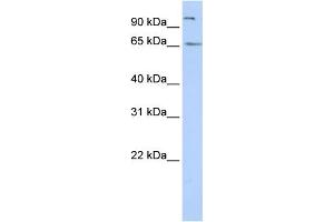 WB Suggested Anti-SPATA16 Antibody Titration: 0. (SPATA16 anticorps  (N-Term))