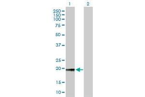Western Blot analysis of NOP56 expression in transfected 293T cell line by NOP56 MaxPab polyclonal antibody. (NOP56 anticorps  (AA 49-174))