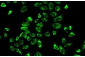 Immunofluorescence analysis of A-549 cells using HSD3B2 Polyclonal Antibody (HSD3B2 anticorps)