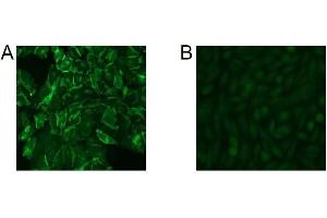 Immunofluorescence Microscopy of CHO cells using D14HD11. (CD66acde anticorps)