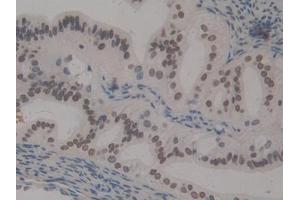 Detection of HMGN1 in Mouse Ovary Tissue using Polyclonal Antibody to High Mobility Group Nucleosome Binding Domain Protein 1 (HMGN1)