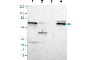 Western blot analysis of Lane 1: RT-4, Lane 2: U-251MG sp, Lane 3: Human plasma (IgG/HSA depleted), Lane 4: Human with DPYSL2 polyclonal antibody  at 1:250-1:500 dilution. (DPYSL2 anticorps)