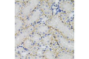 Immunohistochemistry of paraffin-embedded mouse kidney using SLC1A4 antibody (ABIN5971578) (40x lens). (SLC1A4 anticorps)