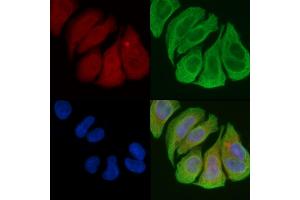 ABIN6258488 and ABIN6274479 staining Hela cells(45 min of heat-shock) by IF/ICC. (IP6K3 anticorps  (Internal Region))