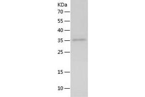Interleukin 21 (IL21) (AA 18-146) protein (His-IF2DI Tag)