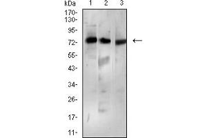 Western blot analysis using BTRC mouse mAb against Ramos (1), MCF-7 (2), and K562 (3) cell lysate.