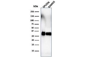 Western Blot Analysis of Ramos cells and human spleen tissue lysate using HLA-DRB Monoclonal Antibody (SPM288). (HLA-DRB1 anticorps)
