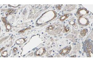 ABIN6277492 at 1/100 staining Human prostate tissue by IHC-P. (RRM2 anticorps  (C-Term))