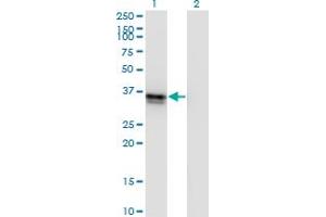 Western Blot analysis of FRZB expression in transfected 293T cell line by FRZB monoclonal antibody (M01), clone 4F7. (FRZB anticorps  (AA 102-190))