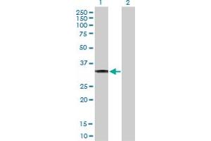 Western Blot analysis of CBR3 expression in transfected 293T cell line by CBR3 MaxPab polyclonal antibody. (CBR3 anticorps  (AA 1-277))