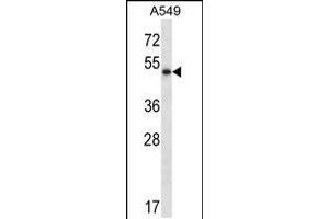 Western blot analysis in A549 cell line lysates (35ug/lane).