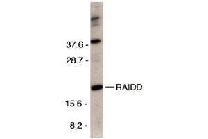 Western Blotting (WB) image for anti-CASP2 and RIPK1 Domain Containing Adaptor with Death Domain (CRADD) (C-Term) antibody (ABIN1030612) (CRADD anticorps  (C-Term))