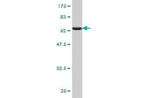 Western Blot detection against Immunogen (65. (PCBP2 anticorps  (AA 1-362))