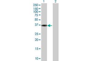 Western Blot analysis of DFNA5 expression in transfected 293T cell line ( H00001687-T01 ) by DFNA5 MaxPab polyclonal antibody. (DFNA5 anticorps  (AA 1-295))