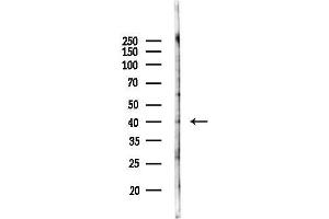 anti-Arginine Vasopressin Receptor 2 (AVPR2) (Internal Region) antibody