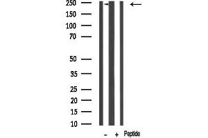 anti-Dysferlin (DYSF) (C-Term) antibody