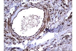 Image no. 13 for anti-Tumor Necrosis Factor Receptor Superfamily, Member 8 (TNFRSF8) (AA 19-379) antibody (ABIN1491084)