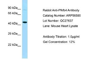 Western Blotting (WB) image for anti-6-phosphofructo-2-Kinase/fructose-2,6-Biphosphatase 4 (PFKFB4) (Middle Region) antibody (ABIN2786783) (PFKFB4 anticorps  (Middle Region))