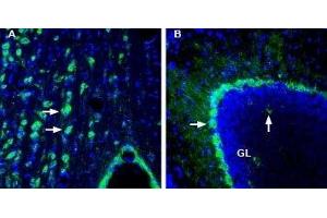 Expression of DP2 receptor (CRTH2/GPR44) in rat medial septum and mouse cerebellum - Immunohistochemical staining of perfusion-fixed frozen rat and mouse brain sections with Anti-CRTH2/GPR44 (extracellular) Antibody (ABIN7043564, ABIN7045118 and ABIN7045119), (1:200), followed by goat-anti-rabbit-AlexaFluor-488.