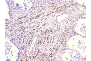 IHC analysis of PCDH15 using anti-PCDH15 antibody (ABIN6719362). (PCDH15 anticorps)