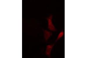 ABIN6274335 staining Hela cells by IF/ICC.