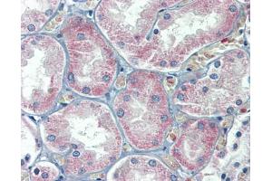 Immunohistochemistry (IHC) image for anti-Solute Carrier Family 27 (Fatty Acid Transporter), Member 2 (SLC27A2) (N-Term) antibody (ABIN2781594)