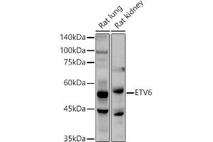 Western blot analysis of extracts of various cell lines, using ETV6 antibody (ABIN3022302, ABIN3022303, ABIN3022304, ABIN1512878 and ABIN6218719) at 1:1000 dilution.
