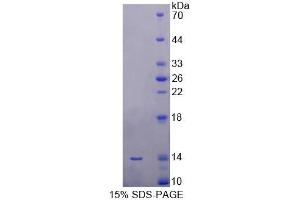 SDS-PAGE analysis of Human SRP9 Protein.